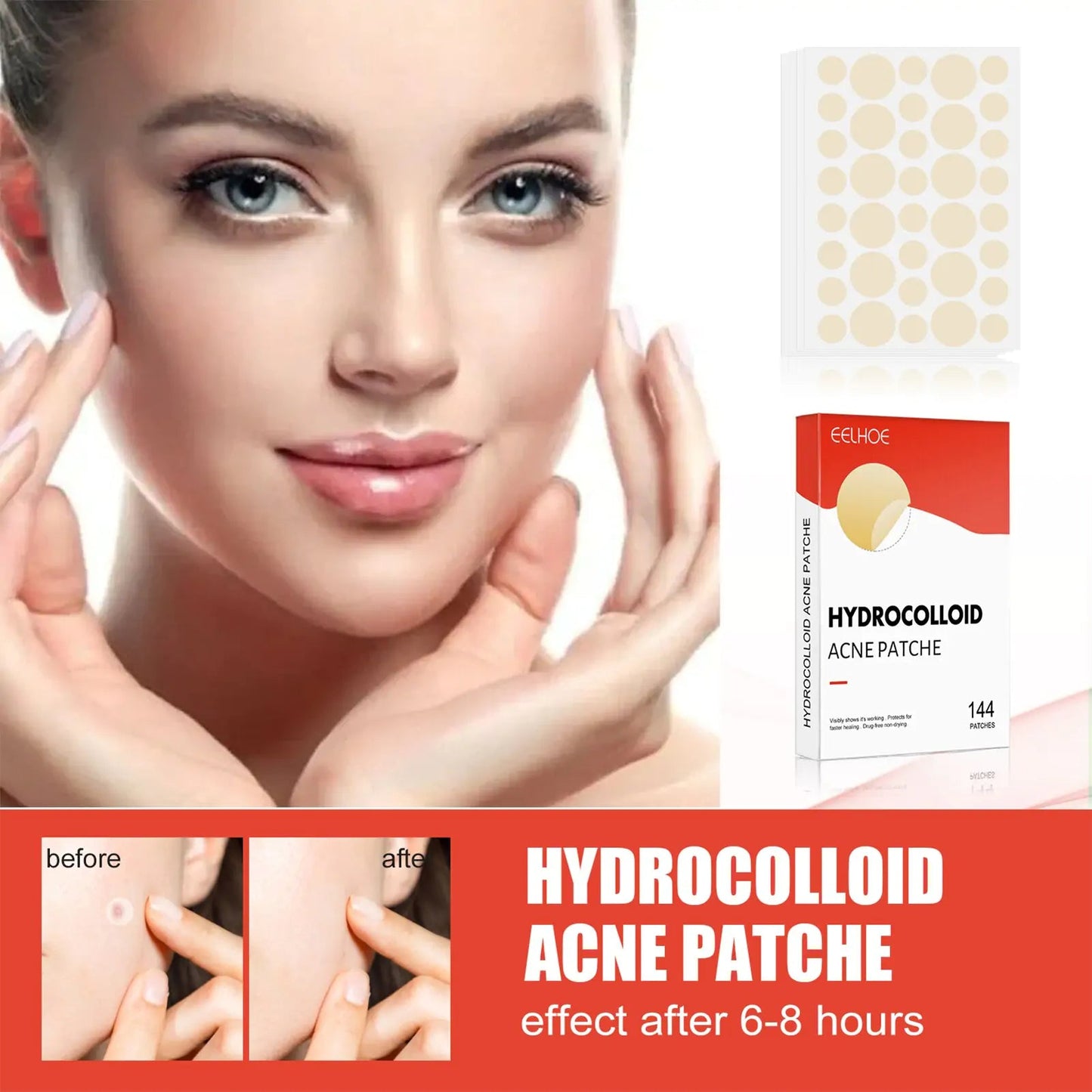 Invisible Acne Patch