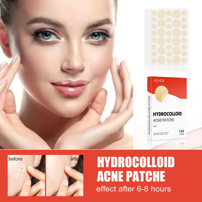 Hydrocolloid Acne Patches