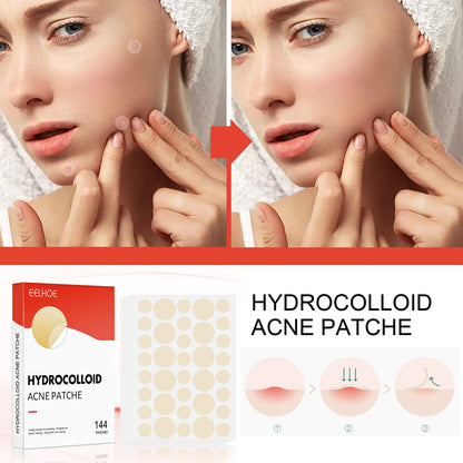 Hydrocolloid Acne Patches